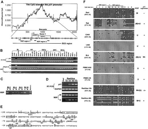 Figure 1. Expression and methylation status of p21 in various cell lines and primary tumors. (A) The CpG island in the p21 promoter includes the core promoter, exon 1 (with 2 splicing variants) and part of intron 1. A DNA region with an observed/expected CpG ratio of more than 0.6 and a GC content of more than 50% is considered a CpG island.10 The transcription start site is indicated by bent arrows (based on NCBI database). The 2 discrete MSP regions and one BGS region analyzed in the p21 CGI are indicated. Region 1 corresponds to the area studied by Roman-Gomez et al2 and Shen et al,3 while region 2 has also been studied by Shen et al. MSP primers used are as follows, for region 1 (methylated), p21m1: 5′-TTAGGTTTAGTTGGTTCGGC, p21m2: 5′-ACTAACGCAACTCAACGCG; for region 2 (methylated), p21bm1: 5′-GTGAACGTAGTATATATTCGC, p21bm2: 5′-ATAAAACCGAAACTAAACGCG; and for region 2 (unmethylated), p21bu1: 5′-TTGTGAATGTAGTATATATTTGT, p21bu2: 5′-TTATAAAACCAAAACTAAACACA. Primers for BGS are as follows: p21BGS1, 5′-AGGGAAGTGTTTTTTTGTAGT and p21BGS2, 5′-TAACCAAAAATTCCTATACTTA. MSP primers have been tested for not amplifying any unbisulfited DNA. MSP and BGS were performed as previously described.10 (B) Representative semiquantitative reverse transcriptase–polymerase chain reaction (RT-PCR) and MSP results of p21 in cell lines. GAPDH was used as a control for RT-PCR.10 M indicates methylated; U, unmethylated; EsCa, esophageal carcinoma; NPC, nasopharyngeal carcinoma; BrCa, breast carcinoma. (C) Representative MSP results in several primary BLs. (D) Demethylation and activation of p21 in Rael after treatment with 5 μM 5-aza-2′-deoxycytidine (Aza). Hours of treatment are indicated by 12 h, 24 h, 48 h, and 96 h. (E) Partial sequence of the p21 promoter CGI. CpG sites are bolded. The transcription start site is marked as a bent arrow. The TATA box is capitalized. Six Sp1 binding sites and some other regulatory elements (E2F, STAT) within this sequence are underlined. MSP primers for region 1 are framed. (F) High-resolution methylation analysis of the p21 promoter by BGS, which reveals the methylation status of every CpG site in the studied region. A 576-bp region spanning the p21 promoter with 64 CpG sites was analyzed, with the 2 MSP regions labeled. The p21 exon 1 is labeled by a dot-framed box. Each CpG site is shown at the top row as a number. BGS results of 4 lymphoma cell lines (Rael, Raji, CA46, and L540), 2 normal PBMCs, and 1 primary BL are shown. Each row in the grid, next to the sample name, represents an individual allele of the p21 promoter analyzed by BGS in that sample.10 Filled circles are methylated CpG sites and open circles are unmethylated CpG sites. % M is the percent of methylated CpG site of all CpG sites analyzed. M indicates methylated; U, unmethylated; (M), weakly methylated; (U), weakly unmethylated; NA, not available.