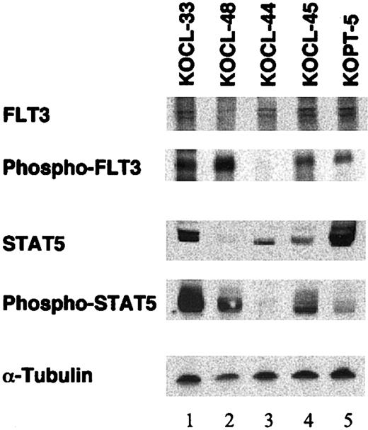 Figure 1. Western blot analysis on tyrosine phosphorylation of FLT3 and STAT5 in leukemia cell lines with or without D835 mutations. Lysates of leukemia cell lines with (lanes 1-2) or without (lanes 3-5) FLT3-D835 mutations were separated, blotted, and stained with antibodies against FLT3, phosphotyrosine (after immunoprecipitation by anti-FLT3), STAT5, phospho-STAT5, and α-tubulin, respectively. Lanes 1, 3, and 4 were B-precursor cell lines with MLL rearrangement; lane 2 was a monocytoid cell line with MLL rearrangement; lane 5 was a T-lymphoid cell line.