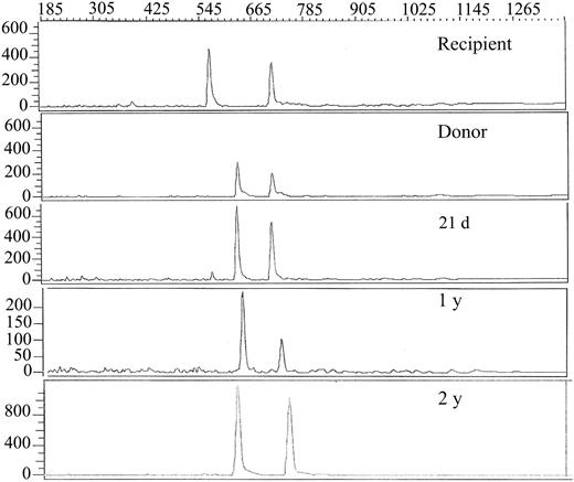 Figure 3. Assessment of donor chimerism. Electrophoretic profiles of informative variable number of tandem repeat PCR products18 of the recipient and donor (before transplant) and serial posttransplant samples from the recipient bone marrow at indicated time points after HSCT. The donor and recipient are both heterozygous with one shared allele. Thus, one informative donor allele (644 bp) and one informative recipient allele (578 bp) are observed.