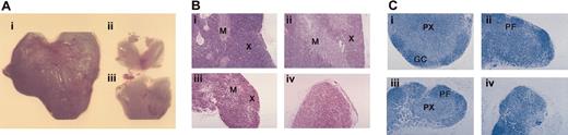 Figure 1. Thymic and lymph node atrophy in ApcMin/+ mice. (A) Thymi from (i) wt and (ii-iii) ApcMin/+ animals at 100 days of age showing the reduction in size and variable rate of atrophy in ApcMin/+ mice. (B) Thymic histology of (i) wt thymus and (ii-iv) ApcMin/+ thymi at 100 days of age. Three different thymi from the same age ApcMin/+ animals are shown demonstrating the initial depletion of cortical thymocytes and the variable rate and stages of atrophy. The most advanced stage of atrophy is shown in panel iv. Sections are stained with H and E. X indicates cortex; and M, medulla. (C) Lymph node histology of (i) wt and (ii-iv) ApcMin/+ lymph nodes at 100 days of age. Inguinal lymph nodes from 3 different ApcMin/+ animals at various stages of atrophy are shown demonstrating the progressive depletion of the paracortex. Sections are stained with Giemsa. PX indicates paracortex; PF, primary follicle; and GC, germinal center. Original magnification, × 10 (A); × 200 (B-C).