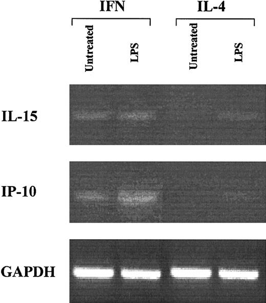 Figure 3. Expression of IL-15 and IP-10 in IFN-DCs from CML patients. DC cultures were generated by treating freshly isolated monocytes from CML patients with either IFN-α/GM-CSF or IL-4/GM-CSF for 3 days, followed by a further 20-hour incubation in the presence or absence of LPS. At that time point, total RNA was extracted from the different cell samples and RT-PCR was performed. PCR for IL-15, IP-10, and GAPDH was carried out as described in “Materials and methods.” The results obtained with cells from 1 representative patient out of 3 are shown.