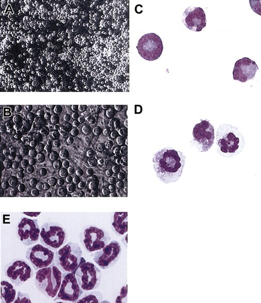 Figure 5. Neutrophil-generating regions (NGRs) contain differentiating neutrophils at all stages of maturation intimately associated with the OP9 cells. The composition of day-5 and day-7 NGRs was evaluated using fine needle aspiration to harvest loosely associated cells on the surface of these colonies. The aspirated cells were cytospun and stained with the Hema 3 staining kit (Fisher Scientific). Purified mouse bone marrow band 3 neutrophils were isolated as described in “Materials and methods.” (A) Low-power phase contrast photograph of NGRs from differentiating cells grown for 5 days in the neutrophil differentiation mix (× 180 final magnification). (B) At a higher magnification, differentiating neutrophils at multiple stages of maturation can be seen (× 400 final magnification). (C) Photograph of neutrophils harvested by fine needle aspiration from the same colony shown in panel A and stained with the Hema 3 staining kit (× 1500 final magnification). (D) Neutrophils harvested by fine needle aspiration from the surface of a day-7 NGR demonstrating polysegmented nuclei (× 1500 final magnification). (E) Hema 3–stained mouse bone marrow band 3 neutrophils (× 1500 final magnification).
