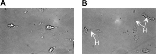 Figure 9. MEKK1–/–-derived neutrophils display altered cell migratory behavior, with periods of hyperextension related to impaired release of their trailing edge. The migratory behavior of wild-type and MEKK1–/– ES/OP9-derived neutrophils was assessed by videotaping cell migration using a Zigmond chamber. As seen in panel A, neutrophils are migrating toward the gradient, which is on the left with a normal morphology. In panel B, the majority of MEKK1–/–-derived neutrophils are also migrating toward the left, frequently exhibiting impaired tail release and hyperextension (H). Original magnification × 280.