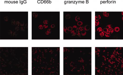 Figure 1. Visualization of perforin and granzyme B by confocal microscopy. Isolated, ethanol-fixed PMNs were incubated with either mouse IgG or monoclonal antibodies to CD66b, granzyme B, or perforin. Then, Cy3-labeled antibody to mouse IgG was added. The bottom row shows an overview (original magnification × 400); the top row is a zoom (original magnification × 2.4) on selected cells to show details.