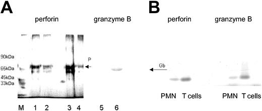 Figure 3. Presence of perforin and granzyme B in lysates of PMNs. (A) By immunoadsorption, perforin was found in lysates of freshly isolated T lymphocytes (2 and 1 × 106; lanes 1 and 2, respectively) and freshly isolated PMNs (5 × 106; lane 3), and to a lesser degree in PMNs cultivated for 48 hours in IFN-γ (100 U/mL lane 4; detected by silver staining). The presence of granzyme B in PMN lysates was shown by Western blotting (lane 6). Lane 5 shows the respective negative control (mouse IgG in place of antibody to granzyme B). M represents the molecular size marker. (B) Detection of perforin- and granzyme B-specific message by RT-PCR. RNA was extracted from highly purified PMNs (106) or T cells (106); then, RT-PCR was performed with primers specific for either perforin or granzyme B. The RT-PCR products obtained from PMN RNA were of similar size as those derived from T cells.
