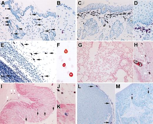 Figure 1. Murine mast cell distribution in NOG mice. (A-D) Toluidine blue staining of the skin of NOG mice. Thin frozen sections from 12-week-old (A-B) and 20-week-old (C-D) NOG mice were stained with acidic toluidine blue. Arrows in the picture from 12-week-old NOG mice (A) indicate metachromatically stained cells. The upper dermis of 20-week-old NOG mice shows bandlike proliferation of toluidine blue+ cells and hyperplasia of epidermis. Magnification, × 200 (A,C) and × 400 (B,D). (E) Toluidine blue staining of mesentery of 20-week-old NOG mice, and arrows indicate mast cells. Magnification × 200. (F) Safranin-O staining of peritoneal cells obtained from 20-week-old NOG mice. Magnification, × 400. (G-K) Alcian blue and safranin-O staining in Carnoy fixed preparations from 20-week-old NOG mice. In lung, a few safranin+ CTMCs were recognized around major airways (H), whereas safranin-negative, Alcian blue+ MMCs were not observed in alveoli (G). In the gastric stomach, NOG mice showed safranin+ CTMCs in the submucosa (arrowheads in I and image with hypermagnification in J), and safranin-negative, Alcian blue+ MMCs in mucosa (arrows in I and image with hypermagnification in K). Magnification, × 100 (G,I), × 200 (H), and × 400 (J-K). (L-M) Toluidine blue staining of Carnoy fixed preparations from lymph node (L) and spleen (M) from 20-week-old NOG mice. Mast cells located only at the capsule of the lymph nodes. In the spleen, a few mast cells were present as shown with arrows in M. Magnification, × 200 (L-M).