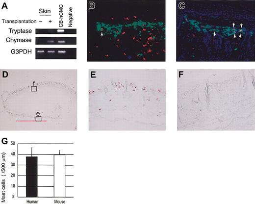 Figure 3. Human mast cell development in the mouse skin. (A) RT-PCR analysis for tryptase and chymase mRNA expression. The skin of NOG mice 12 weeks after the transplantation of human CD34+ cells expressed human mast cell-specific tryptase and chymase mRNA. CB-hCMC indicates cord blood-derived human cultured mast cells. (B-C) Acetone-fixed frozen sections of NOG mouse skin 12 weeks (B) and 20 weeks (C) after the transplantation of human cord blood CD34+ cells were stained for human CD45 (red fluorescent with Cy3), mast cells (yellowish green with FITC-avidin), and nuclei (blue with Hoechst 33342). Arrows indicate human CD45+ mast cells, which are stained orange. Magnification, × 200. (D-F) Human MC specific chymase+ cells in the mouse skin. Acetone-fixed frozen sections of NOG mouse skin 24 weeks after the transplantation were stained with antihuman chymase mAb. Human chymase+ cells proliferated focally in the upper dermis (e), represented by the bar bellows, whereas in other lesions on the same samples nonstained granulated cells were located in the upper dermis (f). Magnification, × 12.5 (D) and × 200 (E-F). (G) The number of chymase+ human mast cells and nonstained granulated mouse mast cells in NOG mouse skin 24 weeks after the transplantation. The number of human and mouse mast cells supported by mouse dermis was almost identical. Bar graphs display mean ± SD values from 5 different preparations.
