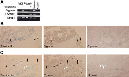 Figure 6. Human mast cell development in the mouse lung and gastric stomach. (A) RT-PCR analysis for tryptase and chymase mRNA expression. The lung and gastric stomach of NOG mice after the transplantation of human CD34+ cells expressed human mast cell-specific tryptase and chymase mRNA. CB-hCMC indicates cord blood-derived human cultured mast cells. (B-C) Histologic findings for lung (B) and gastric stomach (C). Very small numbers of formalin-resistant toluidine blue+ cells appeared in the lung 20 weeks after the transplantation and, in sequential sections, were almost identical to tryptase+ cells (arrows). In gastric stomach, formalinresistant toluidine blue+ cells were identified in both the mucosa and submucosa. In the acetone-fixed frozen thin sections stained with antichymase mAb, chymase+ cells (white arrowheads) were located only in submucosal lesions. Magnification, × 200 (toluidine blue and tryptase) and × 100 (chymase).