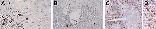 Figure 8. Immunochemical staining for human mast cell-specific chymase in mesentery, lymph nodes, and spleen. (A) In the mesentery, human mast cells formed clusters consisting of 2 to 6 chymase+ cells. (B) In the lymph nodes, chymase+ cells localized around vessels in the trabecula. (C-D) Abundant chymase+ cells were extensively distributed in the red pulp but not in the white pulp of the spleen. Magnification, × 400 (A-B,D) and × 100 (C).