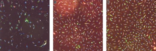 Figure 4. Representative images of cultured endothelial progenitor cells in one patient. (A) Before rhEPO treatment. (B) After 8 weeks of rhEPO treatment. (C) An age- and sex-matched healthy subject is shown for comparison. Original magnification, × 100.