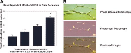 Figure 6. Effect of rhEPO on EPC function. (A) Tube formation index of cocultered EPCs. Supplementation of rhEPO significantly stimulated the formation of tubelike structures in a dose-dependent manner (*P < .05 versus baseline). (B) Representative photomicrographs of tube formation with 1.2 IU/mL rhEPO. Fluorescent-labeled EPCs (red) were coplated with HUVECs (transparent) to form tubular structures. Both cell types were stained with endothelial cell–specific UEA-1 (green fluorescence). Superimposed light and fluorescent images of identical fields reveal that EPCs made a substantial contribution to the cellular network. Original magnification, × 200.