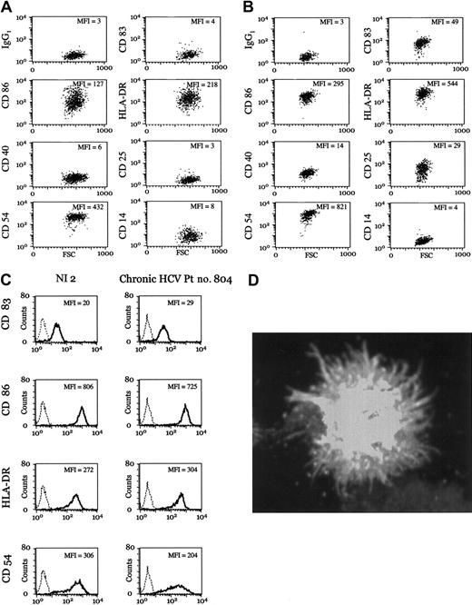 Figure 1. Monocyte-derived DCs from chronic HCV patients undergo normal TNF-α-dependent maturation. (A-B) Representative examples of iDCs (A) and mDCs (B) from chronic HCV patient no. 3. Geometric mean fluorescence intensity (MFI) is indicated. See Supplementary Table S1 for numeric values and additional data on all patients. (C) Representative examples of mDCs from a noninfected (NI) donor and a patient with chronic HCV. Expression of the indicated surface marker (dark lines) is overlaid with the isotype control (dotted lines). All antibodies were obtained from BD Biosciences. (D) The mDCs from chronic HCV patient no. 936 were adhered to Alcian blue-treated coverslips, fixed with 3.4% paraformaldehyde (PFA), and stained with anti-MHC II (clone 93C9), followed by secondary antimouse immunoglobulin G (IgG) Alexa 488. Cells were visualized with a Zeiss Axioplan 200. Original magnification, × 630.