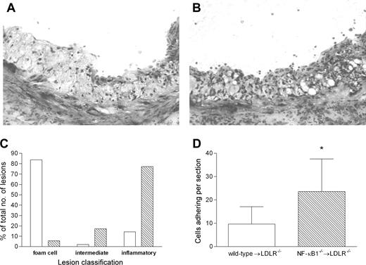 Figure 2. Lesions in LDLR-/- mice transplanted with NF-κB1-/- bone marrow have a more inflammatory phenotype. Representative lesions from wild-type (A) or NF-κB1-/- (B) transplanted mice showing clear cellular differences. Toluidin staining; original magnification, × 200. (C) Lesion classification was categorized as 3 groups: foam cell lesions containing mainly large foam cells; inflammatory lesions containing large numbers of small cells resembling an inflammatory cellular infiltrate; and an intermediate group. Lesion type for wild-type (□) and NF-κB1-/- (▧) transplanted mice is shown as a percentage of the total lesions. All 3 groups were analyzed by Fisher exact test, and a significant shift toward inflammatory lesions was observed in NF-κB1-/- transplanted mice (P < .0001). (D) Cell adherence at the cap of the lesion was counted and indicated as the average number of cells per lesion. *P < .01. Error bars indicate SD.