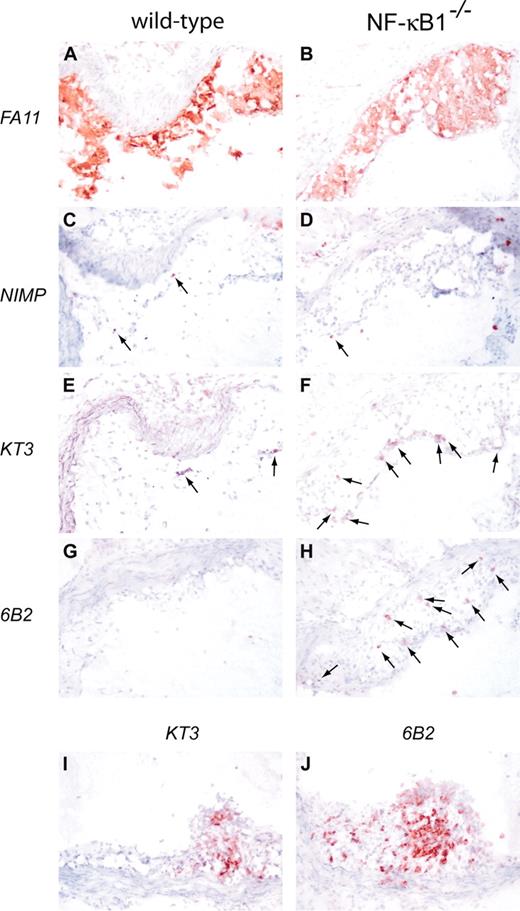 Figure 3. Qualitative analysis of atherosclerotic lesions from wild-type and NF-κB1-/- transplanted LDLR-/- mice. Atherosclerotic lesions from wild-type (A, C, E, G) and NF-κB1-/- (B, D, F, H) transplanted mice were stained for macrophages (A-B), granulocytes (C-D), T cells (E-F), and B cells (G-H). Arrows indicate positive cells. Occasionally, a tertiary lymphoid organization was found in NF-κB1-/- transplanted mice stained for T cells (I) and B cells (J). Hematoxylin counterstained; original magnification × 100.