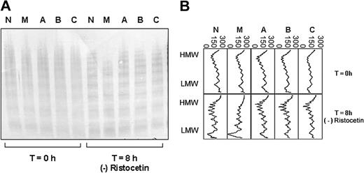 Figure 1. ADAMTS13 proteolysis of VWF from 4 unrelated patients with type I VWD compared with a healthy control. (A) Multimer analysis showing the multimer profile of the VWF in each cryoprecipitate before (T = 0 hours) and after (T = 8 hours) incubation with cryodepleted plasma containing ADAMTS13. M, A, B, and C indicate patients with type I VWD; N represents a healthy control. (B) Densitometric scans of the lanes in A. Individual panels correspond with individual lanes. At T = 8 hours, the loss of HMW multimers, gain of LMW multimers, and quantitative increase in the triplet bands are apparent as proteolysis proceeds. The horizontal axis is optical density: 0 = black, 300 = white.