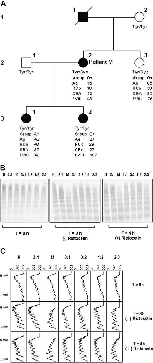 Figure 2. Family study. (A) Pedigree of patient M. □ indicates unaffected male; ▪, affected male; ○, unaffected female; •, affected female; / indicates deceased. Tyr and Cys, respectively, represent tyrosine and cysteine at residue 1584 in VWF, determined by genotype analysis. (B) Multimer analysis showing proteolysis of VWF from each family member. T = 0 hours shows the multimer profile of the VWF in each cryoprecipitate before incubation with cryodepeleted plasma containing ADAMTS13. Incubations were done for fixed time intervals according to the presence (4 hours) and absence (8 hours) of ristocetin. The extent of proteolysis is greater in the case of lanes M and 2:3 both in the presence and absence of ristocetin. (C) Densitometric scans of the lanes in panel B. Each panel corresponds with one lane. In both the presence and absence of ristocetin, the plasma VWF from patient M and sibling 2:3 shows greater proteolysis than that of the other individuals tested. In all cases, proteolysis is accompanied by a quantitative increase in the triplet bands. The horizontal axis is optical density: 0 = black, 500 = white.
