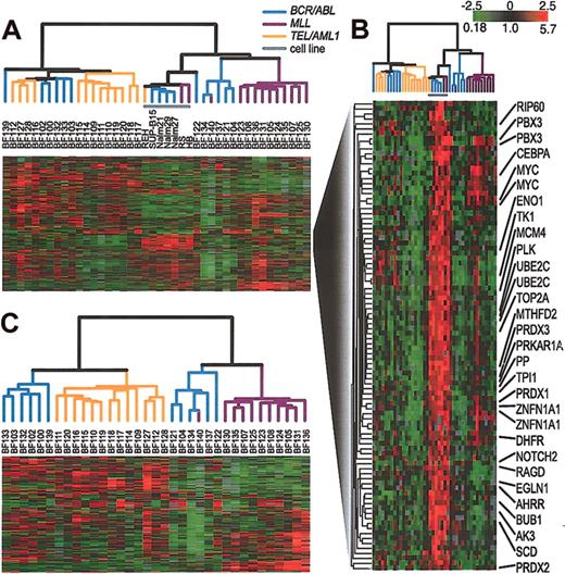 Figure 2. Agglomerative hierarchical clustering according to similarity in gene expression patterns in 35 clinical samples and 7 representative cell lines harboring BCR/ABL, TEL/AML1, or an MLL abnormality. For each cell line and clinical sample, total RNA and reference total RNA (Universal Human Reference; Stratagene) were treated with DNase (DNA-free; Ambion, Austin, TX), linearly amplified, fluorescently labeled (with Cy5- or Cy3-dUTP) and comparatively hybridized to an array containing approximately 43 000 features representing approximately 31 000 unique UniGene clusters. This data set was obtained by using 2 distinct array batches that were produced using 2 different batches of PCR amplifications of the clone inserts. The data for each gene was mean centered by batch. A list of arrays used and the batches to which they belong is contained in the Supplemental Materials. We replaced the gene expression levels obtained from duplicate arrays by their mean expression level. (A) The variation in expression is displayed as a variation in color10 for the 844 clones (representing 758 genes) for which the log2 intensity ratio differed by at least 2 from its mean on at least 2 arrays. The color scale extends from 0.18-fold to 5.7-fold of the mean (-2.5 to 2.5 in log2 space) as indicated in the upper-right corner. Gray represents omitted data. The arms of the dendrogram are color-coded to indicate the chromosomal translocation associated with each branch: purple indicates MLL; orange, TEL/AML1; and blue, BCR/ABL. The gray bar indicates data obtained from cell lines. (B) A subset of genes from panel A that are highly expressed in cell lines. Gene names are provided for selected named clones. (C) Clustering of the 35 clinical samples shown in panel A. The variation in expression is displayed for the 272 clones (representing 255 genes) for which the log2 intensity ratio differed by at least 2 from its mean on at least 3 arrays. The broad features of the clustering patterns were robust to variations in gene selection criteria.