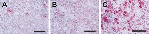 Figure 7. Immunohistochemical labeling. Myeloperoxidase of spleens from a wild-type control (A) and TSLP transgenic (B-C) mice. Myeloperoxidase staining of myeloid cells is increased in transgenic mice. Myeloperoxidase-positive cells are indicated by the purple staining the cytoplasm. Results are representative of 3 independent experiments. Scale bar = 50 μm (A-B) and 100 μm (C).
