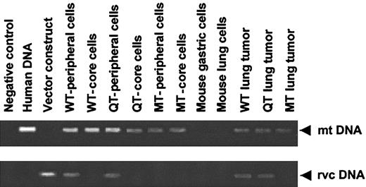 Figure 4. Qualitative PCR analyses of cellular DNA obtained from various tissues by microdissection. Cellular DNA used as a template in these PCR reactions was obtained from microdissected cells as described in “Materials and methods,” and PCR products resolved electrophoretically in 1.2% agarose gels. Cellular DNA from mouse gastric and lung cells were processed in an identical manner to exclude the possibility that the human-specific primer pair cross-reacted with mouse DNA.