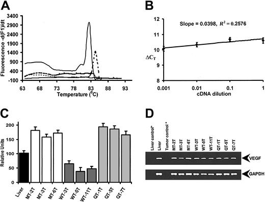 Figure 5. Real-time quantitative RT-PCR analysis of murine VEGF gene expression in tumors. (A) Melting curve analysis of the VEGF and GAPDH amplicons. Distinct melting curves of VEGF (dotted line) and GAPDH (solid line) are shown together with controls. (B) Relative efficiency plot of VEGF and GAPDH. The ΔCT (difference in CT values of VEGF and GAPDH) were calculated for each cDNA dilution. (C) Murine VEGF gene expression levels in MT-1080, QT-1080, and WT-1080 tumor samples. Mouse liver RNA (black bar) was used as a positive control. Each column represents the average of 3 amplification reactions (error bars represent standard deviation) performed on a single cDNA sample reverse-transcribed from RNA derived from each tumor sample. Samples MT-2T, MT-3T, and MT-6T are representative MT-1080 tumors (white bars). Samples WT-3T, WT-5T, and WT-11T are representative WT-1080 tumors (dark grey bars), while samples QT-1T, QT-5T, and QT-7T are representative QT-1080 tumors (light gray bars). (D) Agarose gel analyses of PCR products obtained following specific amplification of murine VEGF (top) and murine GAPDH (bottom) amplicons. * indicates negative controls lacking reverse transcriptase in first-strand cDNA synthesis.