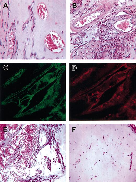 Figure 4. Histologic and immunohistochemical analysis of Matrigel implants. Representative hematoxylin and eosin–stained sections of Matrigel containing VEGF (A) or VEGF plus SnPP (B) implanted in mice and excised 6 days after injection. A dense inflammatory infiltrate around vessels was observed in plugs containing VEGF plus SnPP when compared with VEGF alone (original magnification × 160). (C-D) Double immunofluorescence staining for VWF (C) and MPO (D) showing the presence of leukocytes around vessels in plugs with VEGF plus SnPP (original magnification × 250). (E-F) Representative hematoxylin and eosin–stained sections of Matrigel containing LPS (E) or LPS in the presence of CoPP, which prevented leukocyte-dependent angiogenesis (F) (original magnification × 160).