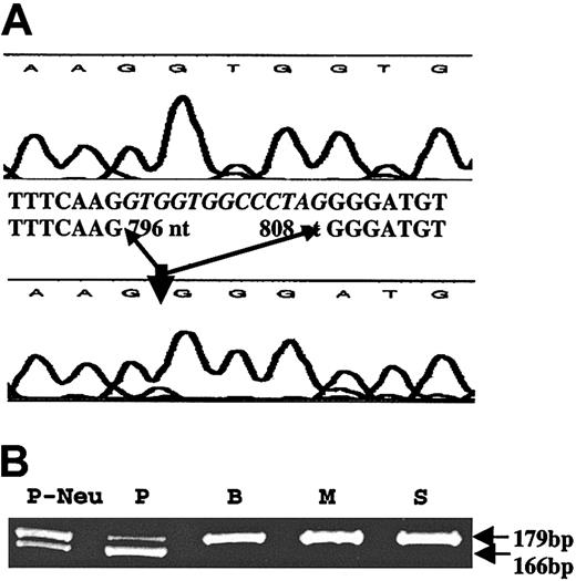 Figure 1. Amplification of platelet RNA by RT-PCR. (A) Platelet RNA from a control subject (top tracing) and the patient (lower tracing) were subjected to RT-PCR using primers flanking exons 3 to 6 of CBFA2. The sequence shows a loss of 13 nt (796-808) in the patient in the Runt domain. (B) Amplification of platelet RNA from the patient (P), and the patient's brother (B), mother (M), and sister (S), and of patient's neutrophil RNA (P-Neu) by RT-PCR using a forward primer in exon 3 and reverse primer in exon 4. Two transcripts of 179 bp (expected size) and 169 bp are noted in the patient with only a single 179-bp transcript in the family members.