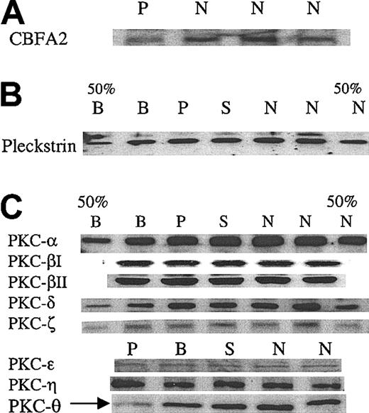 Figure 4. Immunoblot analyses of CBFA2, pleckstrin, and PKC isozymes in platelets. (A) Immunoblot analysis of CBFA2 in platelets. Platelet lysates were subjected to SDS-PAGE and immunoblotting using an anti-CBFA2 antibody. Shown are the results in the patient (P) and 3 control subjects (N). (B) Immunoblot analysis of pleckstrin in platelets. Platelet lysates were subjected to SDS-PAGE and immunoblotting using an antipleckstrin antibody. Shown are the results in the patient (P), brother (B), sister (S), and 2 control subjects (N). 50% B and 50% N represent lanes with 50% protein applied. Pleckstrin levels are normal in the propositus. (C) Immunoblot analysis of PKC isozymes. The details are as described for panel B. PKC-θ levels were decreased in the patient (arrow). The results shown are representative of at least 3 separate experiments. To confirm that protein loading was comparable between the patient and the control subjects, the immunoblots used for PKC-θ were stripped and reblotted using antibodies against PKC-δ and PKC-ζ, which showed that the levels of these PKC in the patient were comparable to those of the other subjects (not shown).