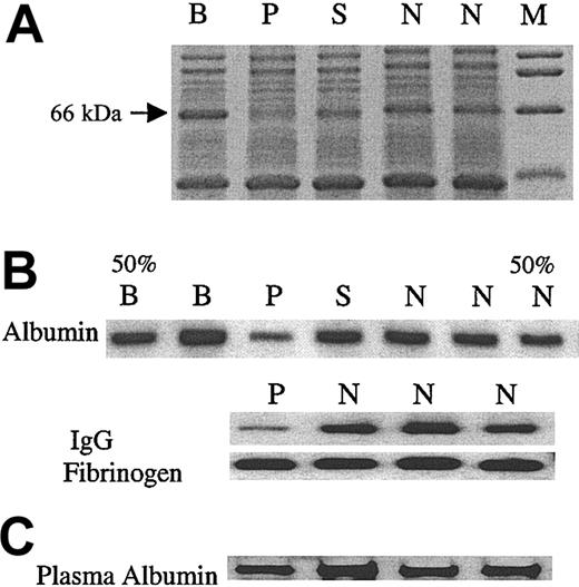 Figure 5. Analysis of platelet proteins, albumin, IgG, and fibrinogen. (A) Platelet lysates were subjected to SDS-PAGE. Gelcode blue-stained gel showing a decrease in an approximate 66-kDa band in the patient (P) but not the family members (B, S) or control subjects (N). M represents molecular weight markers. (B) Immunoblot analyses of albumin, IgG, and fibrinogen in platelet lysates. In the first (50% B) and the last (50% N) lanes, half of the corresponding sample (B, N) was applied, to assess the sensitivity of the analysis. (C) Immunoblot analysis of albumin in plasma. The albumin in patient plasma sample was comparable to that of 3 control subjects (N).