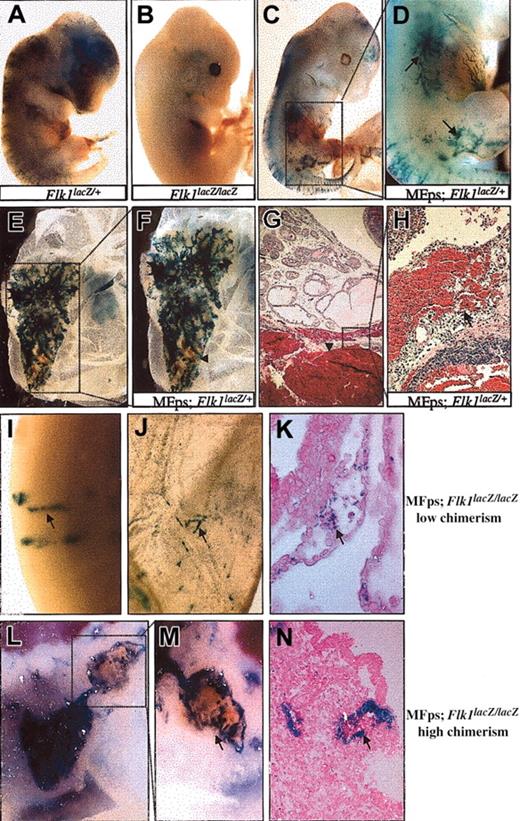 Figure 3. Chimeric analysis of Flk1lacZ/+ and Flk1lacZ/lacZ ES cells expressing the MFps protein. (A) E12.5 chimeric embryo containing Flk1lacZ/+ ES-derived cells showing X-gal–stained vasculature throughout. (B) E12.5 chimeric embryo-derived from Flk1lacZ/lacZ ES cells shows a lack of Flk1 null (X-gal stained) cell contribution to the vasculature. (C-D) Low-degree chimeric contribution of MFps-expressing; Flk1lacZ/+ ES cells leads to normal vascular channel formation (arrows in D point to superficial abdominal and limb vasculature). (E-F) High-degree chimeric contribution of MFps-expressing; Flk1lacZ/+ ES cells leads to aberrant vascular development in the yolk sac and vascular hemorrhage (arrowhead in F). (G-H) Hemangioma isolated from the small intestine of a 3-week-old MFps-expressing Flk1lacZ/+ chimeric adolescent (arrowhead in G). Higher-power magnification of the hemangioma revealed extensive hemorrhaging and hypervascularity in the surrounding tissue of the intestine (arrow in H). (I-K) Low-degree chimera contribution of MFps-expressing Flk1lacZ/lacZ ES cells rescued vascular contribution (arrows) to intraembryonic (I) and yolk sac sites (J-K). X-gal–staining MFps-expressing; Flk1lacZ/lacZ-derived endothelial cells were found in intersomitic vessels in the embryo (arrow in I) and in morphologically normal yolk sac blood vessels (arrow in J). Histologic analysis shows X-gal–stained endothelial cells surrounding hematopoietic cells in the yolk sac vasculature (arrow in K). (L-N) High-degree chimera contribution of MFps-expressing Flk1lacZ/lacZ ES cells lead to aberrant vascular development and hemangioma formation in the yolk sac (L-M). (N) Histologic analysis of the hemangioma seen in panel M demonstrated the MFps-expressing; Flk1lacZ/lacZ null endothelial cells lining the blood filled hemangioma cavity (arrows in M-N). Panels G and H were stained by hematoxylin and eosin; panels K and N were stained by eosin. Original magnification × 8 (A-C, E); × 12 (D, F, L); × 20 (I, J, M); and × 200 (G, H, K, N).