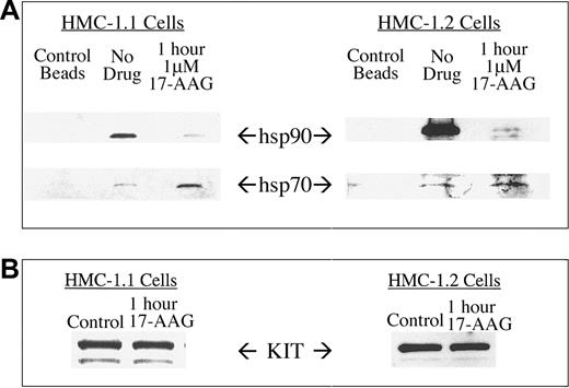 Figure 3. Coimmunoprecipitation of hsp90 and hsp70 with KIT protein. KIT protein was immunoprecipitated from HMC-1.1 and HMC-1.2 cells and associated hsp90 and hsp70 proteins were probed by Western blot analysis (A). Cells were treated with 1 μM 17-AAG for 1 hour. Protein G-Sepharose beads alone were used to exclude the possibility of nonspecific binding. Treatment with 17-AAG for 1 hour was chosen because of minimal change in total KIT levels during that time (B).