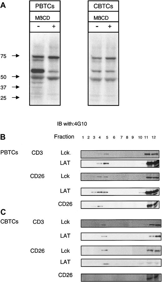 Figure 5. CD26-mediated redistribution of signaling molecules. (A) PBTCs and CBTCs (5 × 106) were left untreated or treated with 10 mM MβCD and incubated at 37°C for 5 minutes. Cells were stimulated via anti-CD26 mAb (1F7; 10 μg/mL) for 30 minutes. Samples were analyzed by SDS-PAGE under reducing conditions and Western blotting for antiphosphotyrosine mAb (4G10). Molecular weight markers are indicated. These results are representative of 10 different donors. (B) PBTCs and CBTCs (1 × 108) were lysed with alpha-methylnorepinephrine (MNE) buffer containing 1% Triton X-100, and the lysates were subjected to equilibrium gradient centrifugation. Electrophoresis of an aliquot of each fraction was performed under reducing conditions, and immunoblotting was performed with anti-Lck, anti-LAT, and anti-CD26 (5F8). (C) Distribution of phospho-Lck in PBTCs and CBTCs was analyzed with immunoblot for phosphotyrosine residues (4G10). The data are representative of 5 different donors.