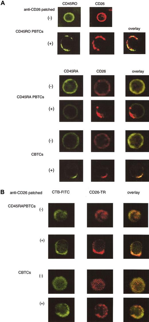 Figure 6. Colocalization of CD26 and CD45RA outside lipid rafts after cross-linking of CD26 in CTBCs. For staining CD45RO+ PBTCs, cells were incubated with biotinylated anti-CD26 mAb (1F7) and cross-linked with Texas red-conjugate streptavidin for patching, as described in “Materials and methods.” After fixation, cells were stained with anti-CD45RO-FITC (UCHL-1). For analysis of CD45RA and CD26, CD45RA+ PBTCs and CBTCs were incubated with biotinylated anti-CD26 mAb (1F7) and cross-linked with Texas red-conjugate streptavidin, as described in “Materials and methods.” Cells were fixed and stained with FITC-conjugated anti-CD45RA mAb (2H4) (A) and CTB-FITC (B) and visualized by confocal microscopy (original magnification, × 400).