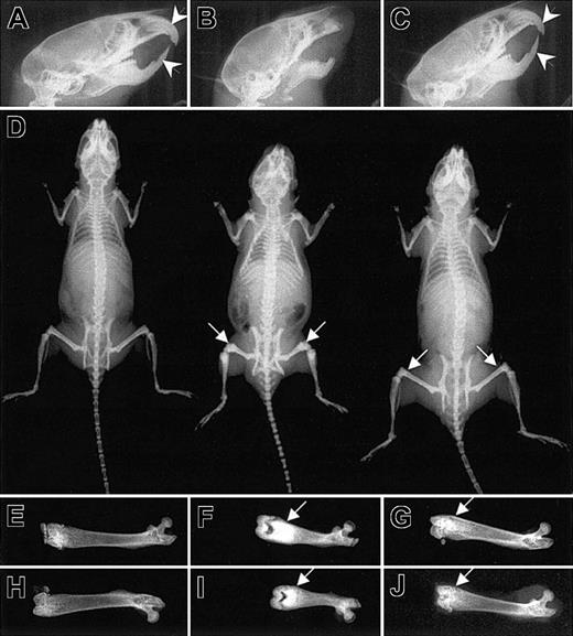 Figure 3. Normal incisor tooth eruption but residual osteopetrosis in the Csf1op/Csf1op; TgCS5/+ mice. Radiograms of 8-week-old wild-type, Csf1op/Csf1op, and Csf1op/Csf1op; TgCS5/+ mice. (A-C) Normal incisor eruptions (arrowheads) in Csf1op/Csf1op; TgCS5/+ mice. (D) Radiographs of whole bodies of wild-type (left), Csf1op/Csf1op (middle), and Csf1op/Csf1op; TgCS5/+ mice (right). (E-J) Radiographs of individual femurs from 2 different wild-type (E,H), Csf1op/Csf1op (F,I) and Csf1op/Csf1op; TgCS5/+ mice (G, J). Arrows in panels D, F, G, I, and J point to the areas of increased bone density.