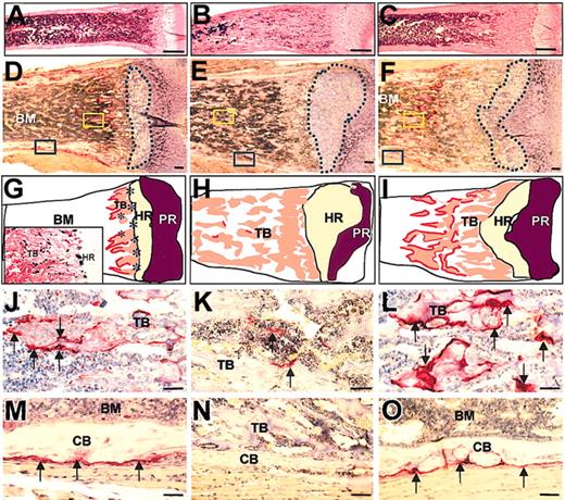 Figure 4. Increased trabecular bone in the subepiphyseal region and normal TRAP+ osteoclast numbers in femurs of 2-week-old Csf1op/Csf1op; TgCS5/+ mice. (A-F) Images of sections of the subepiphyseal regions of the distal femurs from wild-type (A,D), Csf1op/Csf1op (B,E), and Csf1op/Csf1op; TgCS5/+ mice (C,F), stained for TRAP and counterstained with hematoxylin, show the larger amount of unresorbed trabecular bone and smaller bone marrow cavity of the femurs of Csf1op/Csf1op; TgCS5/+ mice compared with those of wild-type mice. (D-F) Regions circled by the dashed blue lines delineate hypertrophic chondrocyte regions. (G-I) Illustration of images in panels D-F shows bone marrow (BM) cavity, trabecular bone (TB), hypertrophic region (HR) of cartilage, proliferative region (PR) of cartilage, and osteoclasts as the red outline of the trabecular bone. Asterisks in HR indicate concentration of CSF-1-expressing cells visualized in CSF-1-promoter-first intron driven lac Z (TgZ) transgenic mice32 and shown in the insert to G. (J-O) High magnification images of regions of yellow (J-L) and blue (M-O) boxed areas in panels D-F, showing the TRAP+ osteoclasts in the regions of trabecular bone (J-L) and periosteum (M-O) in wild-type (J,M), Csf1op/Csf1op (K,N), and Csf1op/Csf1op; TgCS5/+ mice (L,O). TRAP+ osteoclasts (arrows) are stained red. CB indicates cortical bone; bar is 1 mm in panels A-C and 50 μm in panels D-O.