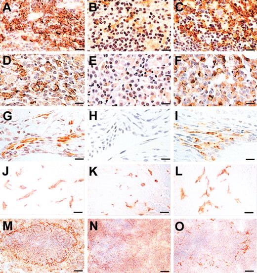 Figure 5. MOMA-1+ and F4/80+ macrophages in tissues of Csf1op/Csf1op; TgCS5/+ mice. (A-L) Paraffin-embedded sections of spleens (A-C), adrenal medulla (D-F), synovial membrane (G-I), and liver (J-L) from 3-month-old wild-type (A,D,G,J), Csf1op/Csf1op (B,E,H,K), and Csf1op/Csf1op; TgCS/+ mice (C,F,I,L) stained with the macrophage-specific anti-F4/80 antibody and counterstained (A-I) with hematoxylin. (M-O) Frozen spleen sections from 1-month-old wild-type (M), Csf1op/Csf1op (N), and Csf1op/Csf1op; TgCS/+ mice (O) stained with the marginal metallophilic macrophage-specific monoclonal antibody, MOMA-1, and counterstained with hematoxylin. MOMA-1+ brown dendritic cells surround the white pulp in spleen. Bars: 50 μm (A-L) and 80 μm (M-O).
