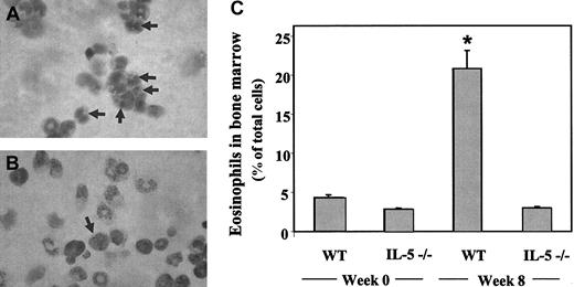 Figure 2. Cytospin preparations of bone marrow cells. Diff-Quik–stained cells from wild-type (A) and IL-5–deficient (B) mice evaluated 8 weeks after inoculation with S mansoni. Eosinophils are indicated at the arrows. (C) Percentage of mature eosinophils detected in bone marrow from S mansoni–infected wild-type and IL-5–deficient mice at zero and 8 weeks after inoculation. Each bar represents average ± SE of absolute counts per 1000 cells from 3 mice of each of the conditions; statistical significance, *P < .01, S mansoni-infected wild-type mice versus any of the other 3 conditions.