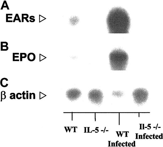 Figure 5. Northern blot analysis confirming findings of gene array. In each lane, total bone marrow RNA (approximately 10 μg) from S mansoni–infected and uninfected wild-type and IL-5–/– mice as indicated, probed with (A) a 86-bp oligonucleotide probe encoding mEar-2, which will cross-react with most of the 15 known genes of the mEar cluster; (B) an 60-bp oligonucleotide probe encoding eosinophil peroxidase (EPO; see “Materials and methods”), and (C) human β-actin. Relative signals (probe/actin) determined by scanning densitometry are as follows: IL-5–/–/WT/:IL-5–/– infected/WT/infected, mEar/β-actin, 0.13:0.19:1.0:16 (16-fold over WT, 86-fold over IL-5–/– infected); mEPO/β-actin, 0.08:0.12:1.0:15 (15-fold over WT, 122-fold over IL-5–/– infected).