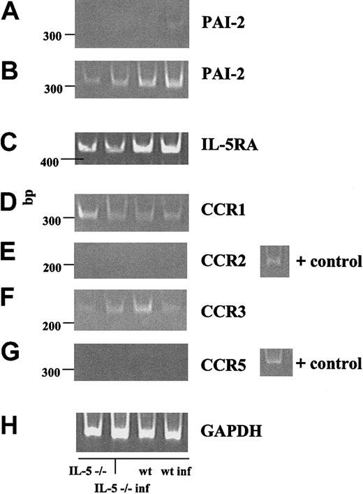 Figure 7. RT-PCR confirmation of specific microarray results. RT-PCR was performed on 0.5-μg samples of total bone marrow RNA. (A-B) The serpin-protease inhibitor PAI-2, at 25 and 30 cycles, respectively. (B-G) Receptors IL-5Rα, CCR1, CCR2, CCR3, and CCR5. (H) glyceraldehyde-3-phosphate dehydrogenase (GAPDH) control. All RT-minus control reactions were negative. Far right lane, positive controls as indicated.