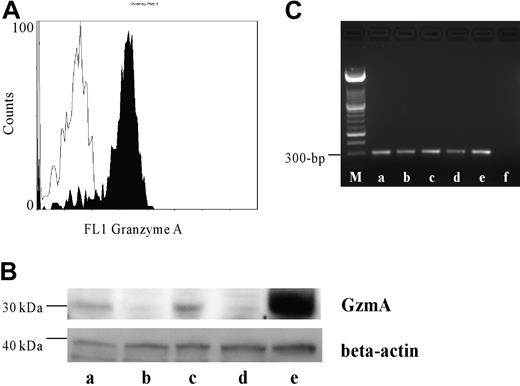 Figure 1. Expression of GzmA in human PMNs. (A) PMNs of 5 different donors were intracellularly stained with antihuman GzmA (black profile) and the respective isotype control (white profile). A representative histogram is shown. (B) Western blotting revealed a strong band between 29 and 35 kDa in PMNs and peripheral blood mononuclear cells (PBMCs), which served as a positive control, typically for GzmA. The blot was reblotted with a mouse antihuman beta-actin antibody to demonstrate that comparable amounts of protein were used. Lanes a through d show human PMNs of 4 different donors, and lane e shows human PBMCs. (C) RT-PCR was performed as described above. Lane a shows human PBMCs as positive control; lanes b through e, PMNs from 5 different donors; and lane f, negative control. M indicates length marker.