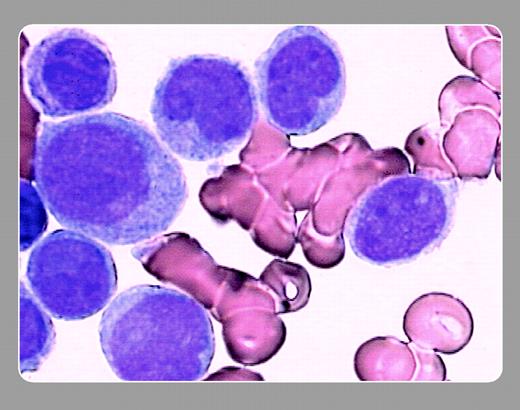 Peter Maslak, Memorial Sloan-Kettering Cancer Center