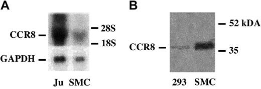 Figure 6. VSMCs contain CCR8 mRNA and membrane-associated CCR8 antigen. (A) RNA blot analysis of CCR8 mRNA in VSMCs. Aliquots (10 μg) of total RNA from Jurkat cells (Ju) or from confluent human VSMCs (SMC) were size-fractionated on agarose gels and hybridized to 32P-labeled human CCR8 cDNA as described in “Materials and methods.” GAPDH is shown as a control for loading of samples. The location of 28 and 19S markers is indicated. The cDNA was generated as detailed in “Materials and methods,” and the identity of the fragment as CCR8 mRNA was confirmed by sequence analysis. (B) Immunoblot analysis of CCR8 in VSMCs. Human VSMC membranes were prepared as detailed in “Materials and methods,” and the solubilized membrane protein and CCR8 expression was analyzed by immunoblot analysis using a polyclonal anti-CCR8, which identified an approximately 40-kDa band.