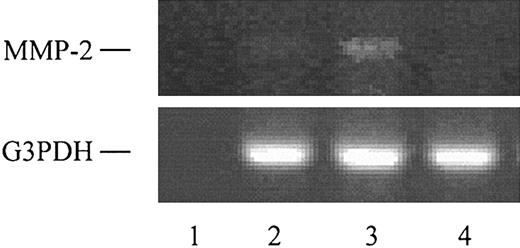 Figure 9. CCL1 induces MMP-2 mRNA in VSMCs. Total RNA was obtained from VSMCs or from human embryonic kidney cells, and the reverse transcriptase–polymerase chain reaction (RT-PCR) was performed using MMP-2 and glyceraldehyde-3 phosphate dehydrogenase (G3PDH) oligonucleotide primers as detailed in “Materials and methods.” Lane 1 shows no RNA control; lane 2, RNA from VSMCs incubated with DMEM; lane 3, RNA from VSMCs incubated 3 hours with 150 ng/mL CCL1; and lane 4, RNA from human embryonic kidney cells. G3PDH was used as an internal control.