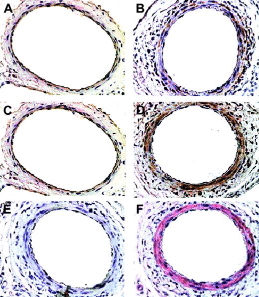 Figure 11. Immunohistochemical analysis of CCR8 and TCA3 up-regulation in injured femoral arteries. Serial sections from femoral arteries from mice 5 days after injury (B,D-F) and from uninjured mice (A,C) were stained for macrophages, MOMA-2 (E, 1:400 dilution), smooth muscle α-actin (F, 1:100 dilution), CCR8 (C-D, 1:5000 dilution), or TCA3 (A-B, 1:10 dilution). Magnification shown is × 40. Cells that stain for CCR8 and TCA3 stain for smooth muscle cell α-actin and both CCR8 and TCA3 are induced in injured vessel. Only rare cells stain for Moma-2.
