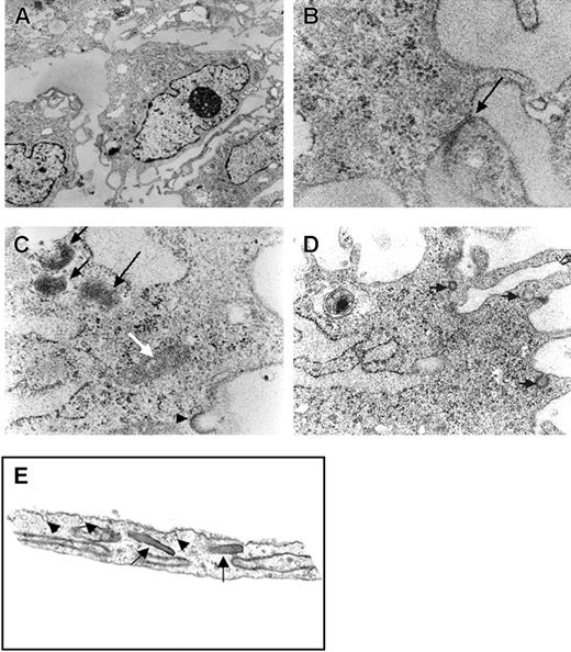Figure 2. Electron photomicrographs of RESDECs. (A) Image showing RESDEC with eccentric nucleus, vesicles, and electron-dense Weibel-Palade bodies (original magnification, × 10 000). (B) Intercellular connection (tight junction) between adjacent cells (arrow) (original magnification, × 100 000). (C) Rod-shaped structures similar to Weibel-Palade body (white arrow), electron-dense, multilamellated structures (black arrows) and exocytotic vesicle (arrowhead) (original magnification, × 63 000). (D) Endocytotic, exocytotic, and intracellular vesicles (arrows) (original magnification, × 40 000). (E) As comparison, electron photomicrograph of human neonatal microvascular endothelial cell demonstrates many similar structures including Weibel-Palade bodies (arrows) and endocytotic/exocytotic vesicles (arrowheads) (original magnification, × 20 000).