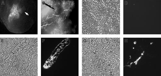 Figure 6. RESDECs induce and form vessels in Matrigel plug. (A) RESDECs were imbedded in a permeable sponge (arrow) that was suspended in Matrigel and implanted subcutaneously. After 28 days, the mouse was injected intravenously with FITC-dextran and the Matrigel plug was removed and imaged to demonstrate neovascularization centered toward the RESDEC sponge. Original magnification, × 10. (B) RESDEC cells were uniformly resuspended in a Matrigel plug and implanted subcutaneously. After 32 days, FITC-dextran was injected intravenously and the plug was removed and imaged to demonstrate intact vessels formed from the RESDEC cells in the plug. Original magnification, × 40. (C-F) IHC demonstrates vessels in Matrigel plug (B) are RESDEC derived. Panels C, E, and G are phase contrast images of cross-sectioned Matrigel with RESDEC-derived vessels, and panels D, F, and H are corresponding fluorescent IHC images using either isotype control (IgG2a) antibody (D) or anti–HLA class I antibody, followed by secondary FITC-labeled antibody (F,H). Original magnifications: × 200 (C-D); and ×400 (E-H).