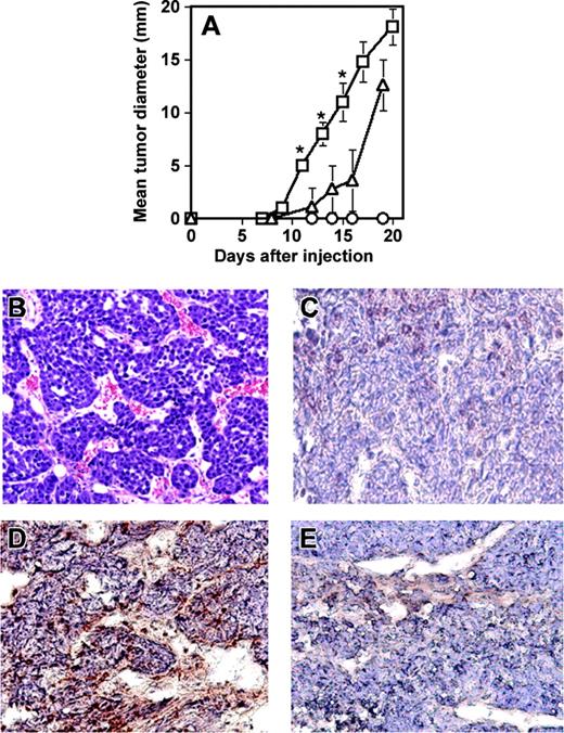 Figure 7. RESDECs lead to more rapid tumor growth and form vessels in tumors. (A) 1 × 106 RESDEC cells (○), 1 × 106 C755 tumor cells (▵), or 1 × 106 of each cell type (□) were injected subcutaneously in SCID mice. Tumors developed earlier in mice coinjected with both cell types. RESDECs alone do not form detectable tumors. Five mice were injected in each group and similar results were obtained in 2 independent experiments. Error bars represent standard deviation of tumor diameter measurements for each group. The asterisk labels time points with statistically significant (P < .01) increased tumor growth at the indicated time point. (B) Hematoxylin and eosin–stained section of C755 tumor coinjected with RESDECs to demonstrate vascularity. (C) C755-derived tumor without coinjection of RESDECs stained for anti–HLA class I antibody that cross reacts with rhesus, but not mouse cells. Minimal staining demonstrates lack of RESDEC-derived vessels. (D) C755 tumor coinjected with RESCDECs stained for anti–HLA class I antibody demonstrates tumor vessels derived from RESDECs. (E) Isotype control (IgG2a) staining of same C755 tumor coinjected with RESDECs as in panel D. Original magnifications: × 200 (B); × 400 (C-E)