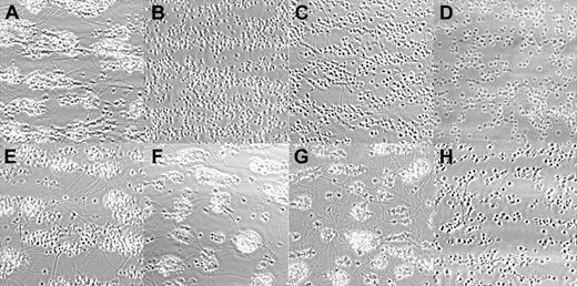 Figure 1. Effects of inhibitory antibodies and receptor antagonists on thrombus formation. Images (120 × 120 μm) were recorded using a phase-contrast microscope after the perfusion of PPACK-anticoagulated whole blood over a collagen-coated surface for 4 minutes at a shear rate of 1000 s–1 Antibodies or inhibitors were added 15 minutes before perfusion. (A) Control. (B-D) 10B12 at 50, 100, or 300 μg/mL, respectively. (E) scFv 1C3 at 100 μg/mL. (F) 6F1 at 20 μg/mL. (G) GFOGER-GPP at 500 μg/mL. (H) ADP-receptor and TxA2 blockade by 40 μM MRS2179, 20 μM AR-C69931MX, 1 U/mL apyrase, and 100 μM ASA. Images shown are representative of 3 to 9 independent experiments. Collagen fibers are visible in some of the panels. Original magnification, × 60.