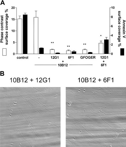 Figure 7. Combined inhibition of GPVI with GPIb or α2β1 abolishes collagen-induced thrombus formation. Blood was treated with the indicated combination of antagonists before perfusion over collagen: 10B12 at 100 μg/mL and 6F1 at 10 to 20 μg/mL, GFOGER-GPP at 500 μg/mL or 12G1 Fab2 at 40 μg/mL perfused over collagen as in Figure 1. (A) Surface coverage of platelet deposition or OG488-labeled annexin V binding (mean ± SE, from 4-6 donors). **P < .001, and *P < .05 compared with single antibody controls. (B) Representative phase-contrast images after perfusion, also showing visible collagen fibers. Original magnification, × 60.