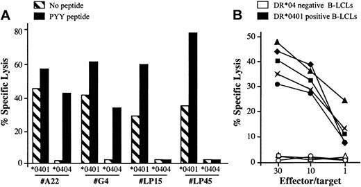 Figure 5. DR*0401-dependent killing of B-LCLs by BHRF1-specific CD4 T-cell clones. (A) Two PBL-derived clones from the healthy donor D3 (LP15 and LP45) and 2 SF-derived clones (A22 and G4) killed a DR*0401 B-LCL, either unloaded or loaded with PYY peptide, while they did not kill an unloaded DR*0404 B-LCL. The 2 SF-derived clones, but not the PBL-derived clones, killed the DR*0404 B-LCL after loading with PYY peptide. Results are expressed as percent specific lysis at E/T ratio 10:1. (B) The CD4 T-cell clone A22 was tested against a panel of 5 DR*0401+ (black symbols) and 3 DR4– (open symbols) unloaded B-LCLs. All DR*0401+ B-LCLs were killed, while DR4– B-LCLs were not.