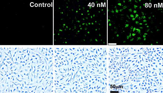 Figure 2. Tβ4 induces transcription of PAI-1 promoter in EA.hy 926 cells. GFP expression in cultured EA.hy 926 cells was analyzed after transfection with pGFP-PAI-1 reporter constructs. EA.hy 926 cells grown in slide chambers at a density of 2 × 105cells/mL were transfected with 1 μg pGFP-PAI-1 using LipofectAMINE and incubated with 0, 40, and 80 nM Tβ4 for 24 hours. The top panels are fluorescent images, and the bottom panels are the corresponding phase-contrast micrographs. This experiment has been repeated 3 times with similar results.